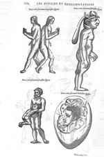 Fig. 265-266-267-268 - Les Oeuvres d’Ambroise Paré, conseiller et premier chirurgien du roy, divisée [...]
