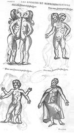 Fig. 273-274-275-276 - Les Oeuvres d’Ambroise Paré, conseiller et premier chirurgien du roy, divisée [...]