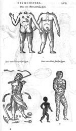 Fig. 284-286-287 - Les Oeuvres d’Ambroise Paré, conseiller et premier chirurgien du roy, divisées en [...]