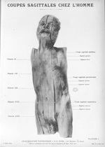 Planche I. Coupes sagittales chez l'homme - Atlas d'anatomie topographique. Vol. 1 [fascicule 1 à 4b [...]