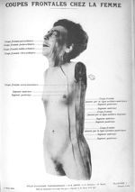 Planche I. Coupes frontales chez la femme - Atlas d'anatomie topographique. Vol. 1 [fascicule 1 à 4b [...]