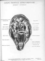 Planche 13. Coupe frontale rétro-orbitaire. Segment antérieur - Atlas d'anatomie topographique. Vol. [...]