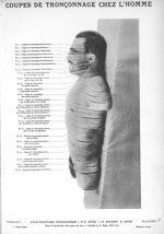 Planche I. Coupes de tronçonnage chez l'homme - Atlas d'anatomie topographique. Vol. 2 [fascicule 5  [...]