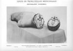 Planche 8. Coupe de tronçonnage médio-nasale. Photographie d'ensemble - Atlas d'anatomie topographiq [...]