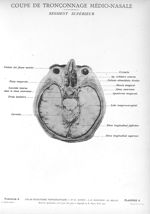Planche 9. Coupe de tronçonnage médio-nasale. Segment supérieur - Atlas d'anatomie topographique. Vo [...]