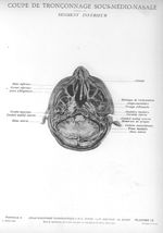 Planche 13. Coupe de tronçonnage sous-médio-nasale. Segment inférieur - Atlas d'anatomie topographiq [...]