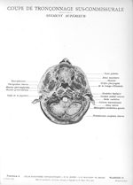 Planche 15. Coupe de tronçonnage sus-commissurale. Segment supérieur - Atlas d'anatomie topographiqu [...]