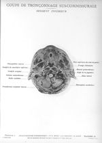 Planche 16. Coupe de tronçonnage sus-commissurale. Segment inférieur - Atlas d'anatomie topographiqu [...]