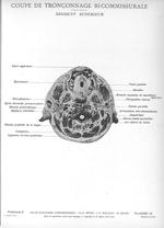 Planche 18. Coupe de tronçonnage bi-commissurale. Segment supérieur - Atlas d'anatomie topographique [...]