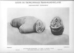 Planche 20. Coupe de tronçonnage trans-mandibulaire. Photographie d'ensemble - Atlas d'anatomie topo [...]