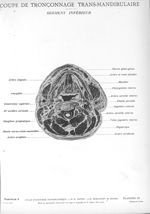 Planche 22. Coupe de tronçonnage trans-mandibulaire. Segment inférieur - Atlas d'anatomie topographi [...]
