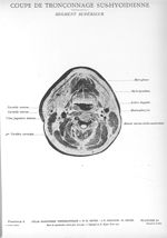 Planche 24. Coupe de tronçonnage sus-hyoïdienne. Segment supérieur - Atlas d'anatomie topographique. [...]