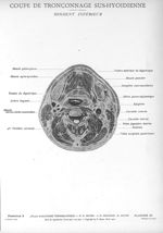 Planche 25. Coupe de tronçonnage sus-hyoïdienne. Segment inférieur - Atlas d'anatomie topographique. [...]