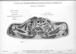 Planche 30. Coupe de tronçonnage sus-scapulo humérale. Segment supérieur - Atlas d'anatomie topograp [...]