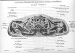 Planche 31. Coupe de tronçonnage sus-scapulo humérale. Segment inférieur - Atlas d'anatomie topograp [...]