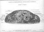 Planche 37. Coupe de tronçonnage sous-scapulo humérale. Segment inférieur - Atlas d'anatomie topogra [...]