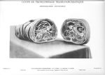 Planche 64. Coupe de tronçonnage trans-pancreatique. Photographie d'ensemble - Atlas d'anatomie topo [...]