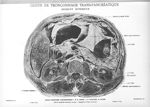 Planche 65. Coupe de tronçonnage trans-pancréatique. Segment supérieur - Atlas d'anatomie topographi [...]