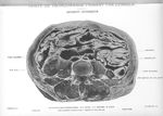 Planche 68. Coupe de tronçonnage passant par l'ombilic. Segment supérieur - Atlas d'anatomie topogra [...]