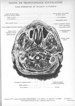Planche 2. Coupe de tronçonnage sus-palatine. Face inférieure du segment supérieur - Atlas d'anatomi [...]