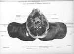 Planche 6. Coupe de tronçonnage sus-hyoidienne. Face supérieure du segment inférieur - Atlas d'anato [...]