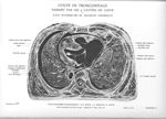 Planche 12. Coupe de tronçonnage passant par les 4 cavités du cœur. Face supérieure du segment infér [...]