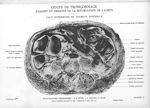 Planche 18. Coupe de tronçonnage passant au dessous de la bifurcation de l'aorte. Face supérieure du [...]
