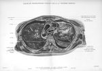 Planche I. Coupe de tronçonnage passant par la 4eme vertèbre dorsale - Atlas d'anatomie topographiqu [...]