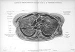 Planche 2. Coupe de tronçonnage passant par la 5eme vertèbre dorsale - Atlas d'anatomie topographiqu [...]