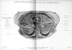 Planche 3. Coupe de tronçonnage passant par la 6eme vertèbre dorsale - Atlas d'anatomie topographiqu [...]