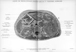 Planche 6. Coupe de tronçonnage passant par la Iere vertèbre lombaire - Atlas d'anatomie topographiq [...]
