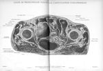 Planche 11. Coupe de tronçonnage passant par l'articulation coxo-fémorale - Atlas d'anatomie topogra [...]