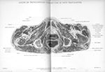 Planche 12. Coupe de tronçonnage passant par le petit trochanter - Atlas d'anatomie topographique. V [...]