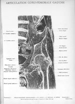 Planche I. Articulation coxo-fémorale gauche - Atlas d'anatomie topographique. Vol. 3 [fascicules 6  [...]