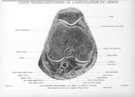 Planche 11. Coupe transcondylienne de l'articulation du genou - Atlas d'anatomie topographique. Vol. [...]