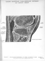 Planche 13. Coupe sagittale para-médiane externe du genou droit - Atlas d'anatomie topographique. Vo [...]