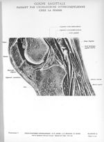 Planche 14. Coupe sagittale passant par l'échancrure intercondylienne chez la femme - Atlas d'anatom [...]