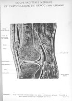 Planche 15. Coupe sagittale médiane de l'articulation du genou chez l'homme - Atlas d'anatomie topog [...]