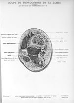 Planche 19. Coupe de tronçonnage de la jambe au niveau du tiers inférieur - Atlas d'anatomie topogra [...]