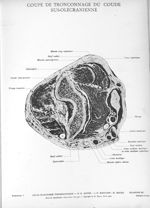 Planche 26. Coupe de tronçonnage du coude sus-olécranienne - Atlas d'anatomie topographique. Vol. 3  [...]