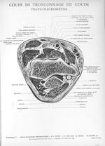 Planche 27. Coupe de tronçonnage du coude trans-olécranienne - Atlas d'anatomie topographique. Vol.  [...]
