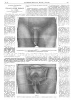 Figure 1. Tracé des incisions / Figure 2. Dissection des paquets ganglionnaire - La Presse médicale  [...]