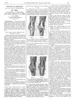 Fig. 1. Le fémur, le tibia et l'articulation du genou ont été largement mis à nu, par la dissection, [...]