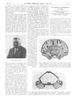 Médecin Colonel E. Jamot / Fig. 1. Sagement postérieur d'une coupe de crâne d'éléphant passant par l [...]