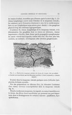 Fig. 8. Nerfs de la muqueuse vésicale au niveau du trigone chez un enfant - Exposé des travaux
