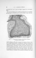 Fig. 11. Transformation adamantine d'un bourgeon épithélial de la gencive adulte. (Inédite) - Exposé [...]