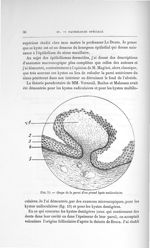 Fig. 15. Coupe de la paroi d'un grand kyste uniloculaire - Exposé des travaux