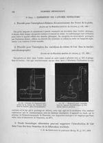 Fig. 32. Schéma de l'appareil indicateur de la vitesse du courant d'air dans la trachée (aéro-dromog [...]