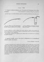 Fig. 37. Modèle de la canule salivaire avec son mandrin T, qui forme à l'autre extrémité une olive f [...]