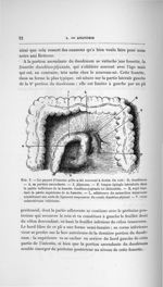 Fig. 7. Le paquet d'intestin grêle a été renversé à droite - Concours pour l'agrégation, section de  [...]